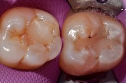 Practitioner corner teeth photo